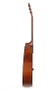 Side